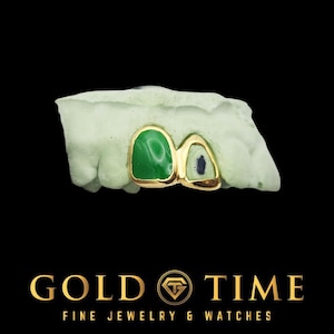 May include: A pair of gold-plated dental grills with green and black inlays, displayed on a light green dental mold. The image is set against a black background, with the text "GOLD TIME FINE JEWELRY & WATCHES" at the bottom.
