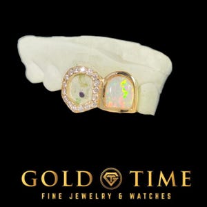 Custom Double Cap Grillz – Opalesque Incisor & Open Face Moissanite Fang – Silver, 10k, 14k Gold -  Luxury Quality Dental Jewelry
