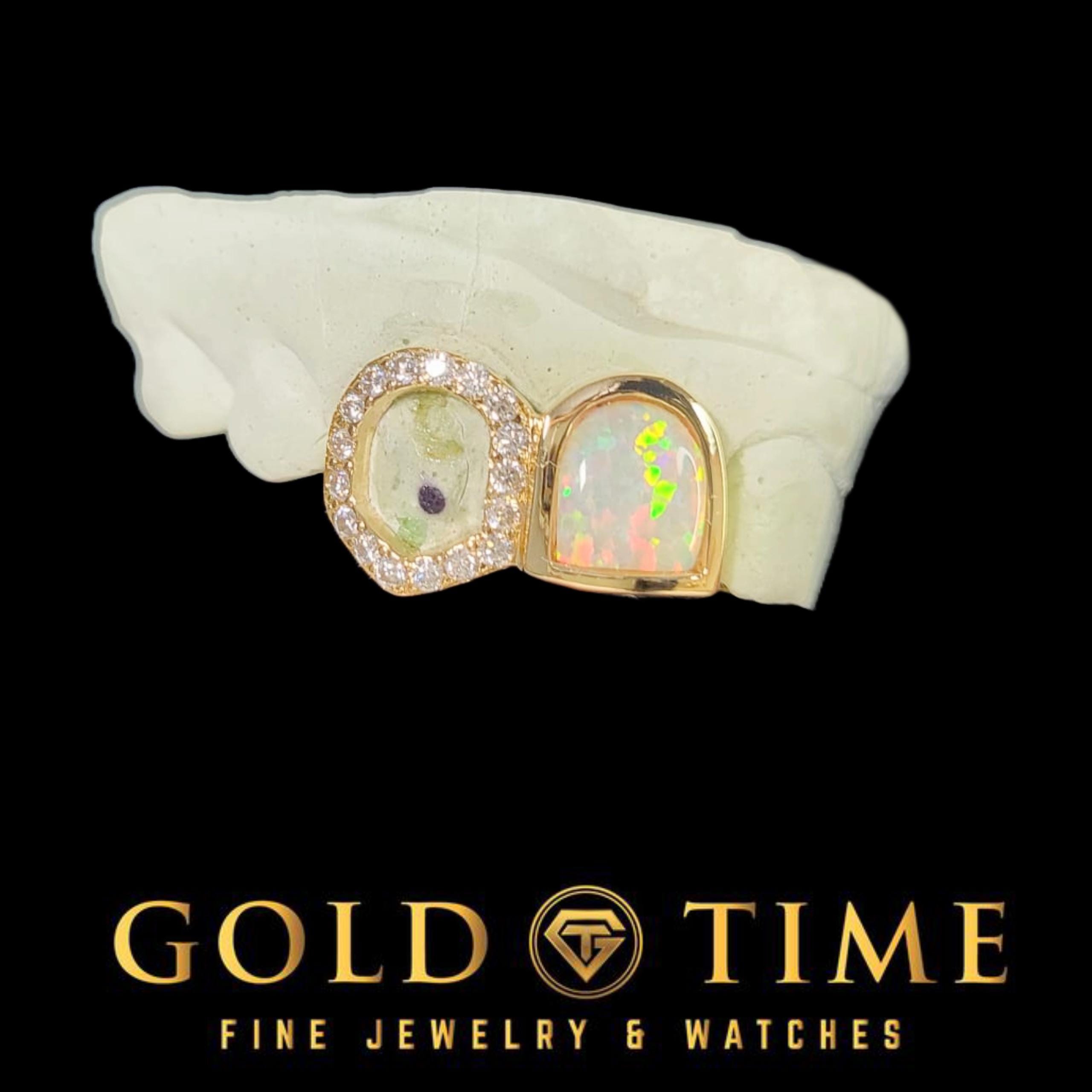 Custom Double Cap Grillz – Opalesque Incisor & Open Face Moissanite Fang – Silver, 10k, 14k Gold -  Luxury Quality Dental Jewelry