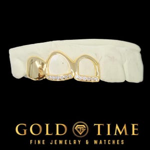 Triple Cap Custom Grillz with CZ Tips and Open Face - Handmade Gold or Silver Grillz - Custom Fit Grillz with Free Mold Kit