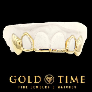 6-Piece Custom Grillz – Solid Front Tips, Open Face & Solid Canines – Silver or Gold – Handmade – Impression Kit Included – Made to Order