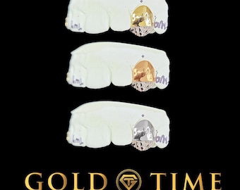 May include: Three sets of gold teeth, each with a different color gold. The teeth are on a white background. The image is from Gold Time Fine Jewelry & Watches.