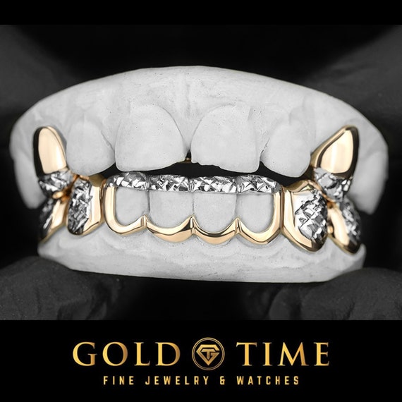 Custom 10-Piece Two-Tone Gold Grillz Set, Window with Trillion Tips, with Impression Kit