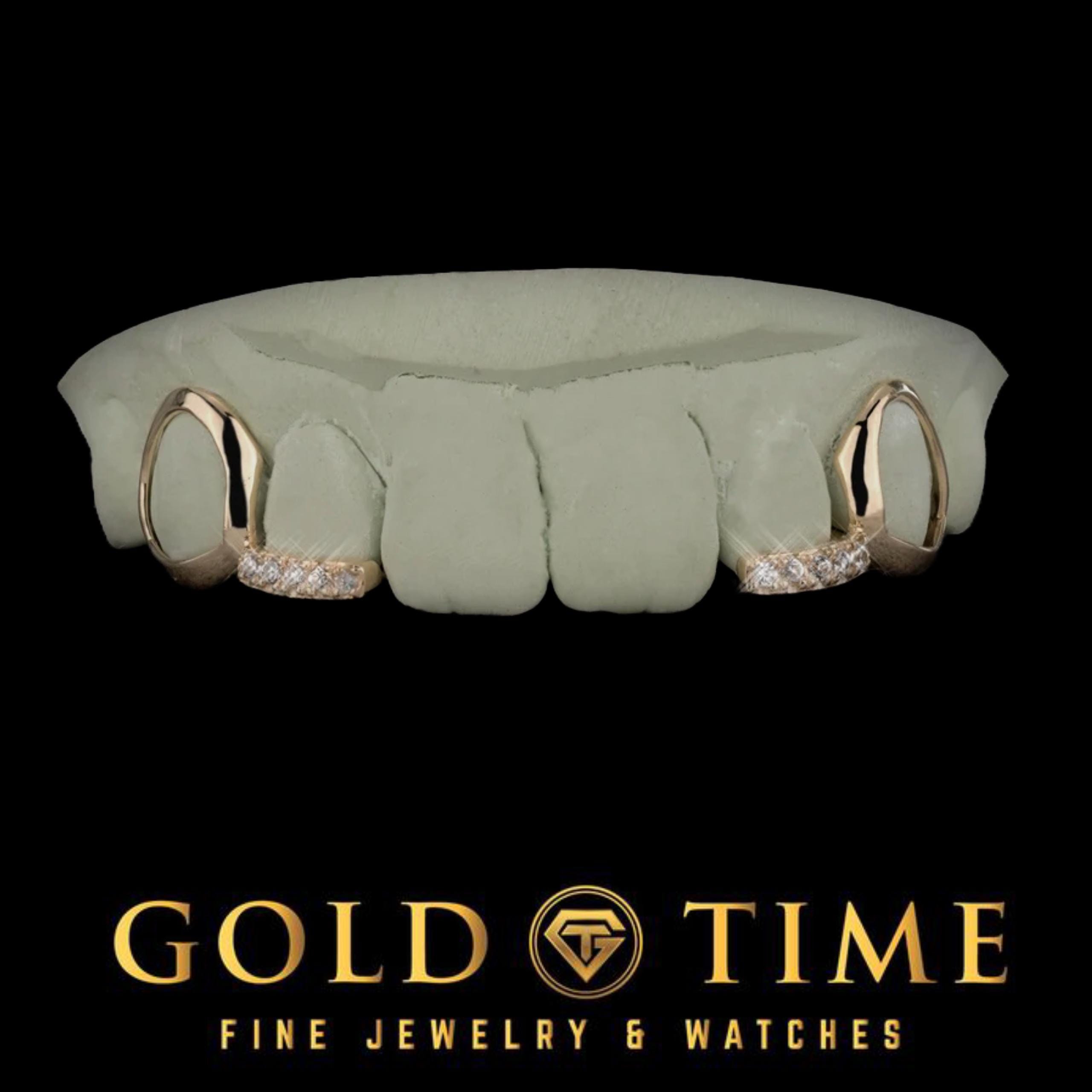 Custom 4-Piece Open Face Grillz with CZ Tip Incisors – Silver, 10K, or 14K - Yellow, White, Rose - Includes Impression Kit, Made to Order