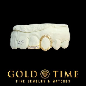 2-teiliger Custom Grillz – Offener Eckzahn mit CZ Tip Schneidezahn – Silber, 10K oder 14K Gold – handgefertigte Passform – Abdruckset inklusive