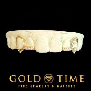 Custom 4-Piece Open Face Fangs with Custom Cut Out and Moissanite Incisor Tips - Personalized Grillz - Gold, Silver, Rose -Includes Mold Kit