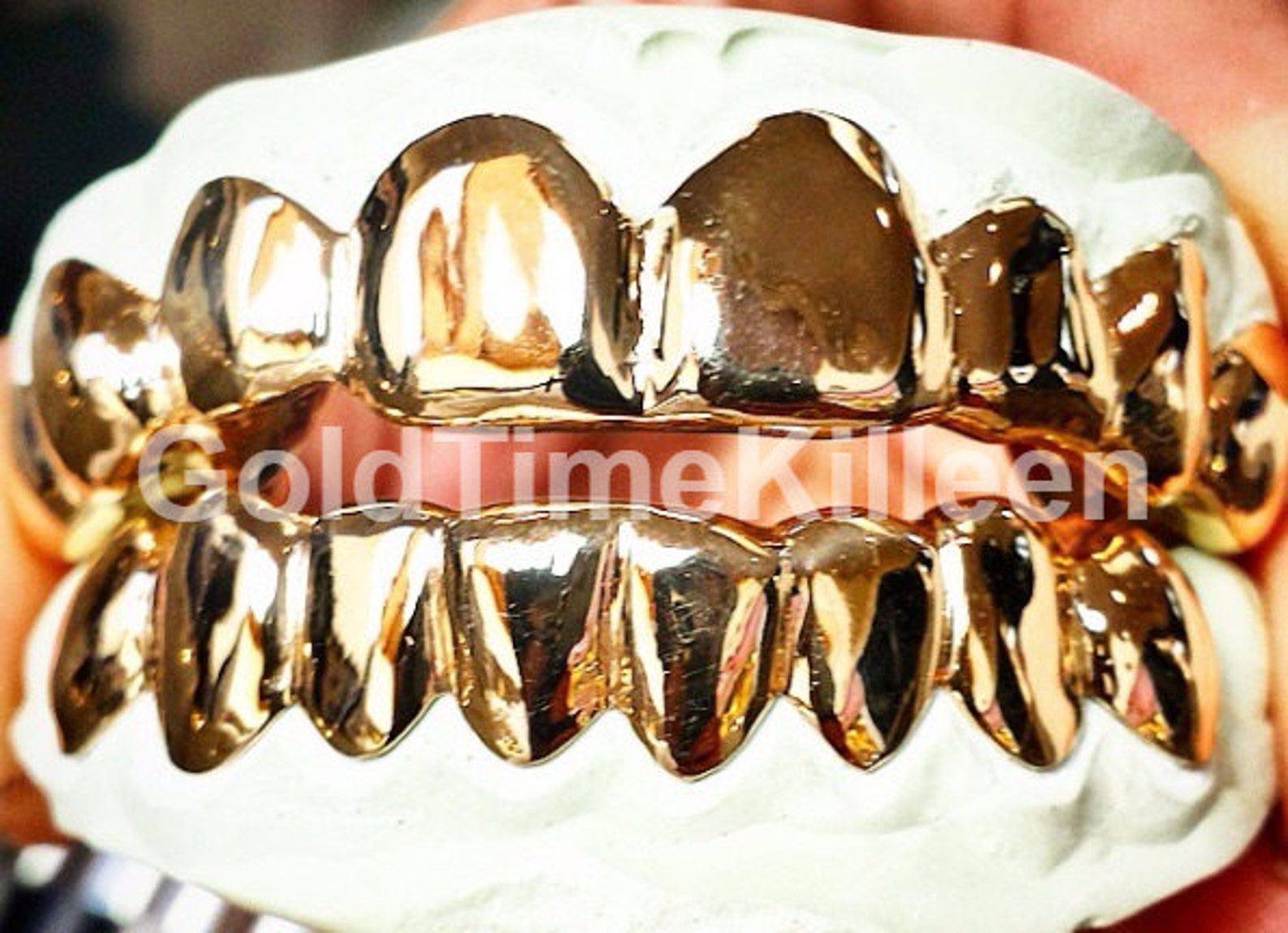 Напыление серебра золотом. Silver Grillz. Штампованная коронка с напылением. Металлическая коронка. Золотые зубные коронки.