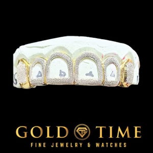 6 Piece Diamond Dust Open Face Grillz with Box Dust Canines – Custom Fit – Silver, Gold, or Rose – Impression Kit Included