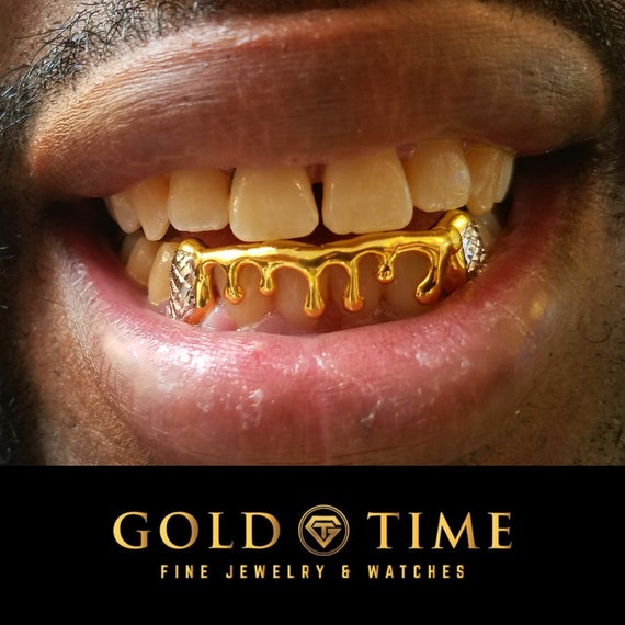 Custom Piece Melting Drip Grillz: Two-tone Trillion Diamond-cut