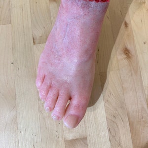 Severed silicone foot