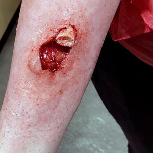 Six piece gelatine prosthetic kit