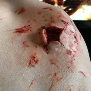 Prosthetic large exit wound. Silicone prosthetic appliance.