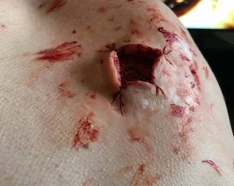 Prosthetic large exit wound. Silicone prosthetic appliance.