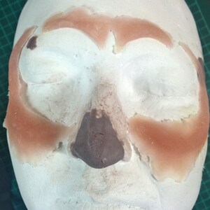 May include: A white plaster mold of a face with brown and peach-colored silicone applied to the forehead, cheeks, and nose.