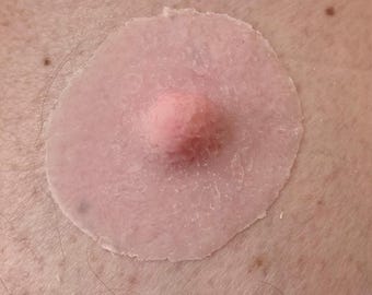 Puede incluir: Primer plano de una venda adhesiva circular de color rosa claro con una zona central rosa elevada. La venda se aplica sobre piel clara, con poros y pequeños pelos visibles.