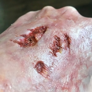 Prótese de pele danificada de silicone encapsulada