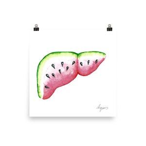 Medische anatomie Art - prachtige aquarel watermeloen lever PRINT
