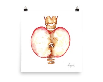 Medical Anatomy Art- Stunning Watercolour Apple Thyroid PRINT