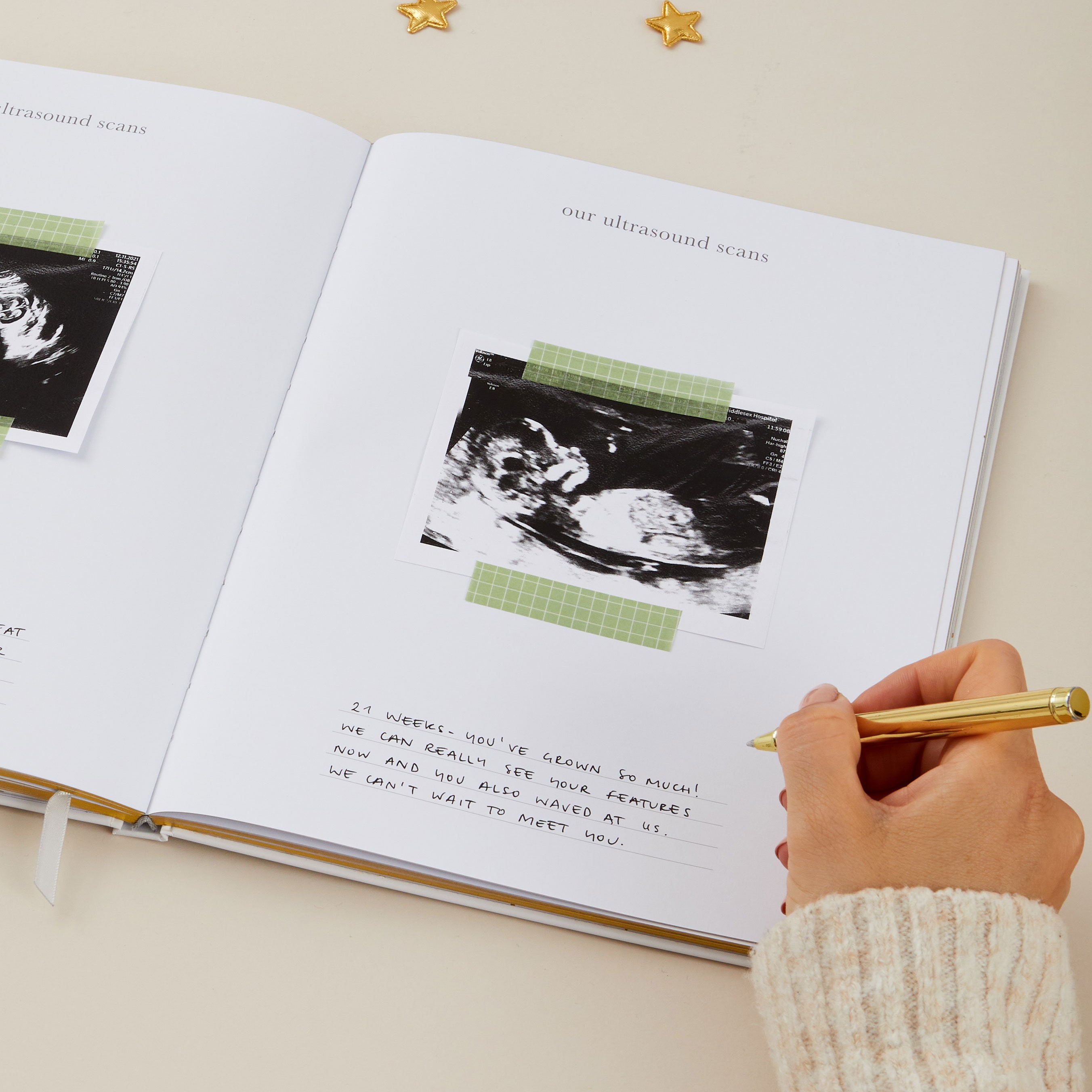 My Pregnancy Journal, Expectant Mother Gift, Pregnancy Planner - Pearl - gift for parents to be, pregnancy record book w/gilded edges
