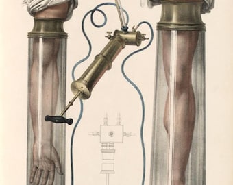 Antique Ars Medical Colour Illustration Of Vacuum Tubes A3 Poster Reprint