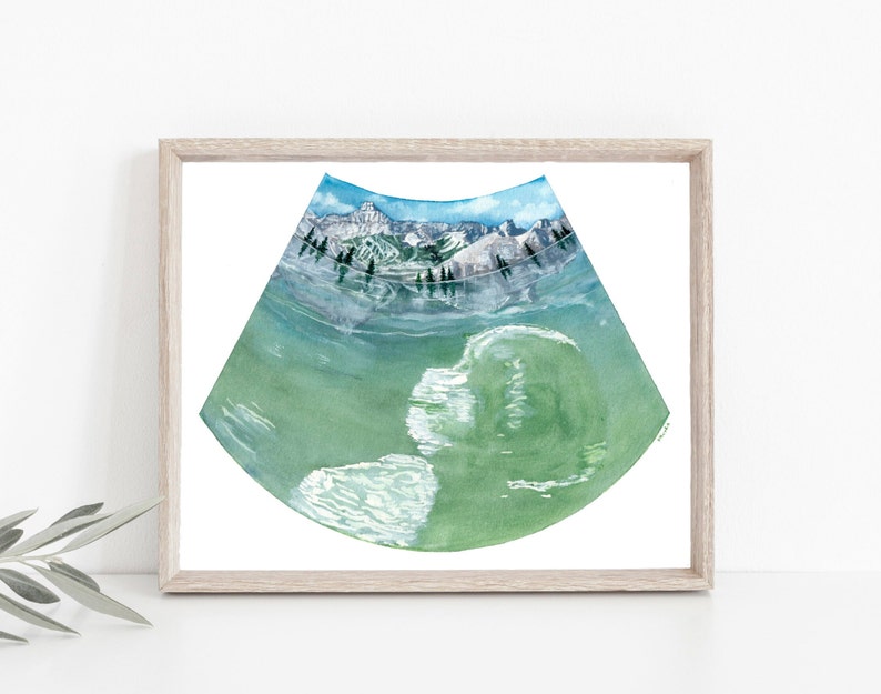 Adventure Baby Sonogram Art CUSTOM ART Gifts for Her Pregnancy Art Baby Shower Gifts Mom to be Expectant Mothers Made to order image 1