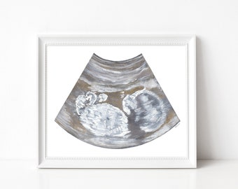 Baby Sonogram Art - CUSTOM ART - Gifts for Her - Pregnancy Art - Postpartum Gifts  - Mom to be - Expectant Mothers -Baby Love-Made to order