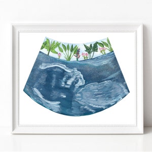 Adventure Baby Sonogram Art CUSTOM ART Gifts for Her Pregnancy Art Baby Shower Gifts Mom to be Expectant Mothers Made to order 8x10 Tropical Baby inches