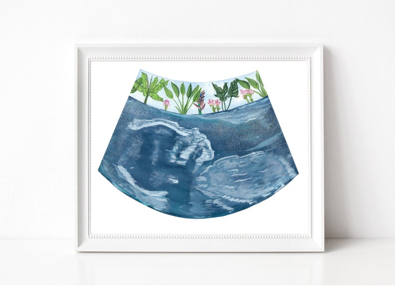 Adventure Baby Sonogram Art CUSTOM ART Gifts for Her Pregnancy Art Baby Shower Gifts Mom to be Expectant Mothers Made to order 8x10 Tropical Baby inches