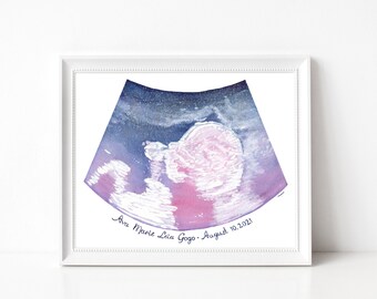 Themed Baby Sonogram Art - CUSTOM ART - Gifts for Her - Pregnancy Art - Baby Shower Gifts  - Mom to be - Grief - Baby Loss - Made to order