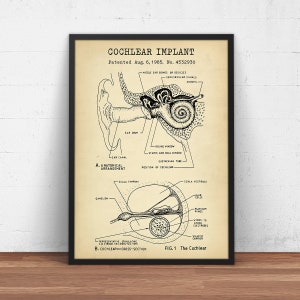 Cochlear Implant Patent Print,  Anatomy Wall Art, Audiologist Gift, Hearing Impaired, ENT Clinic Decor, Doctor Office