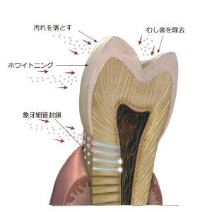 Hydroxyapatite powder for strengthening and remineralising teeth image 4
