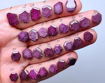 Natural Trapiche Ruby Cabochon – Pattern Gemstone for Jewelry Making (09mm - 15mm)