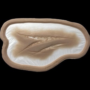 Large laceration prosthetic