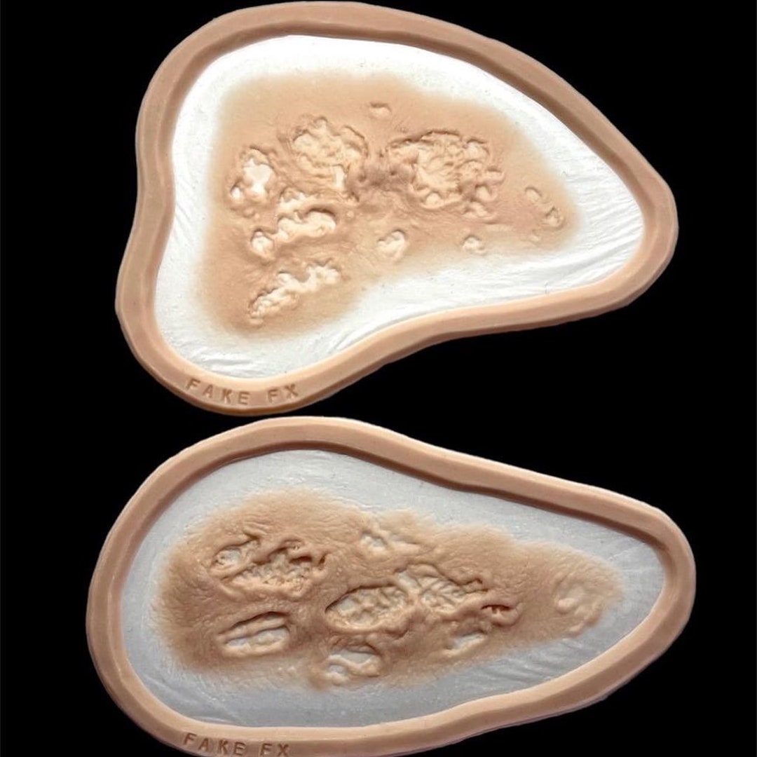 Infected Skin Prosthetic Set 2 - Etsy