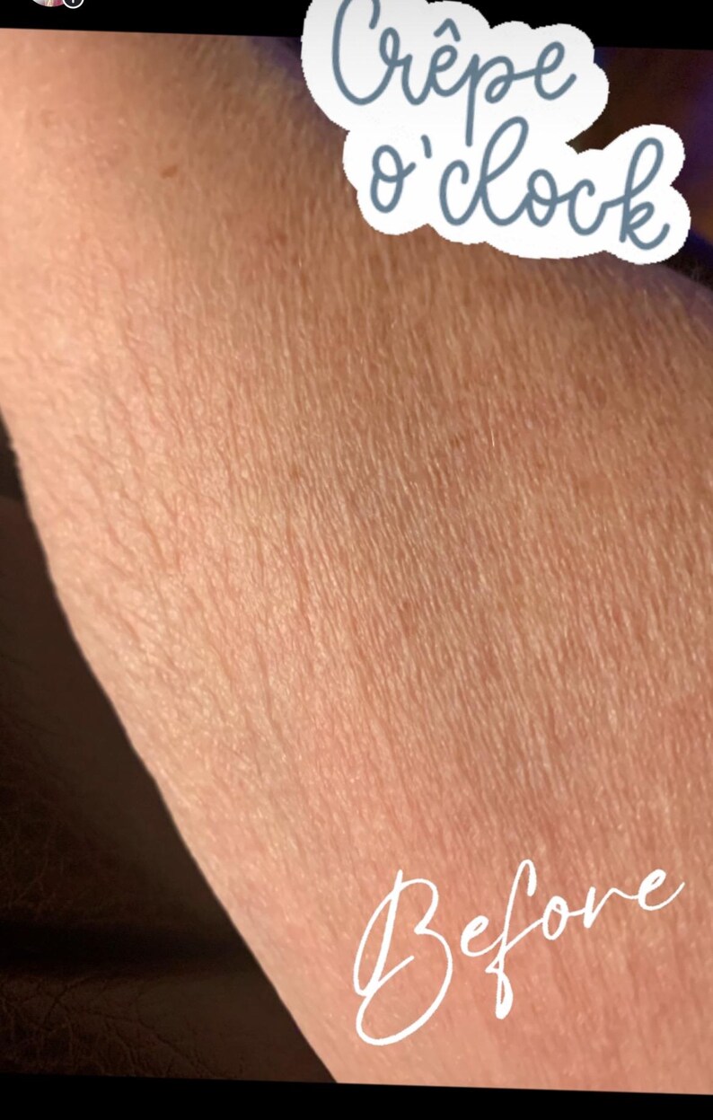 May include: Close-up of a person's arm with visible skin texture. The image includes the text "Cr&ecirc;pe o'clock" in a cloud-shaped design and the word "Before" in cursive, suggesting a skincare or beauty product.