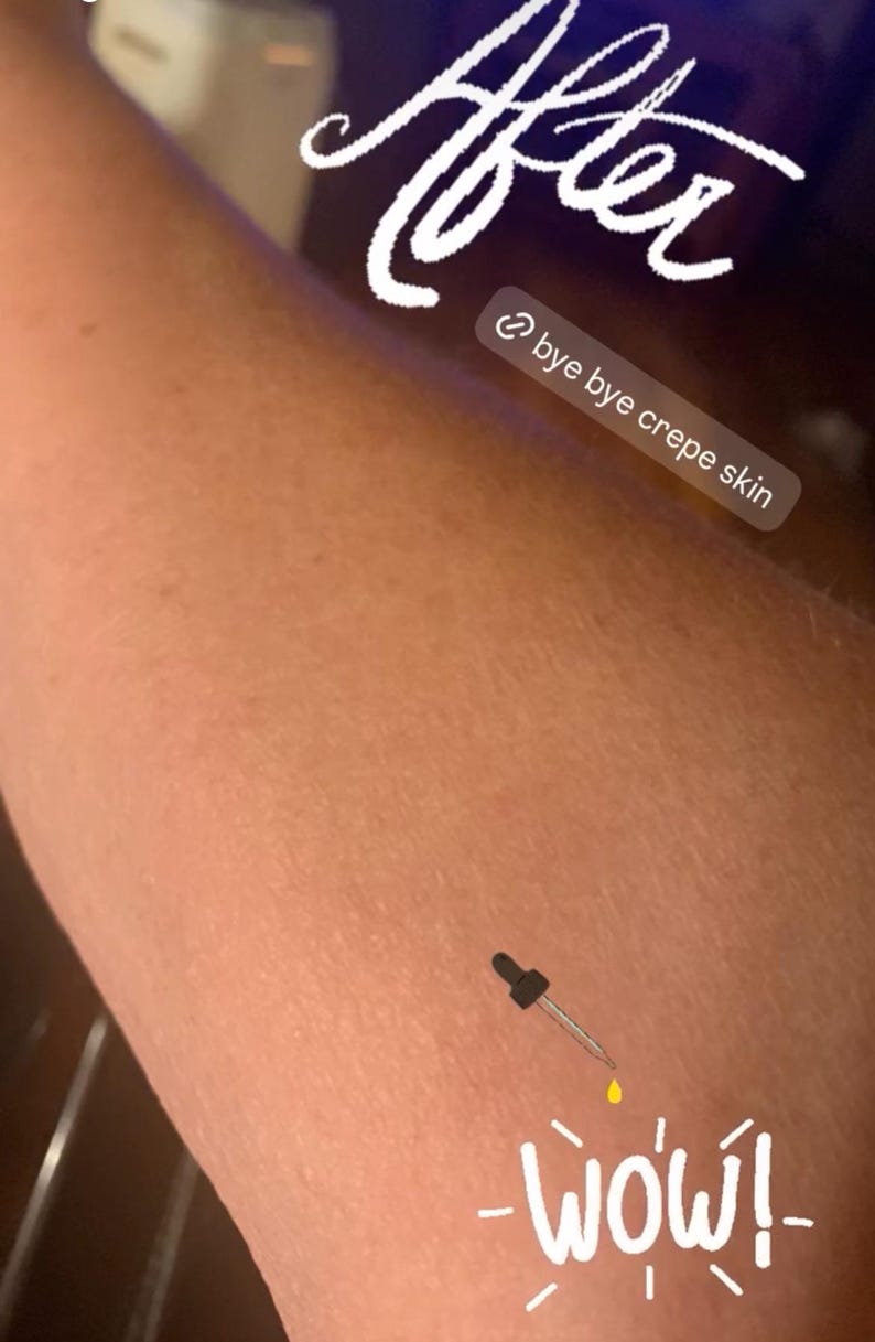 May include: Close-up of an arm with the word "After" in white script. A dropper dispenses a yellow liquid. Text reads "bye bye crepe skin" and "WOW!"