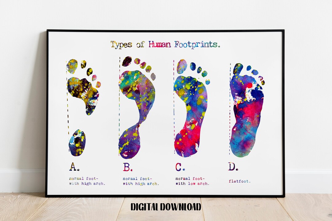 Types of Footprints Orthopedics Art Podiatry Decor Biology Poster