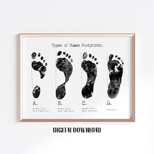 Types of Footprints Orthopedics Art Podiatry Decor biology Poster Medical Science Watercolor Digital Printable Download
