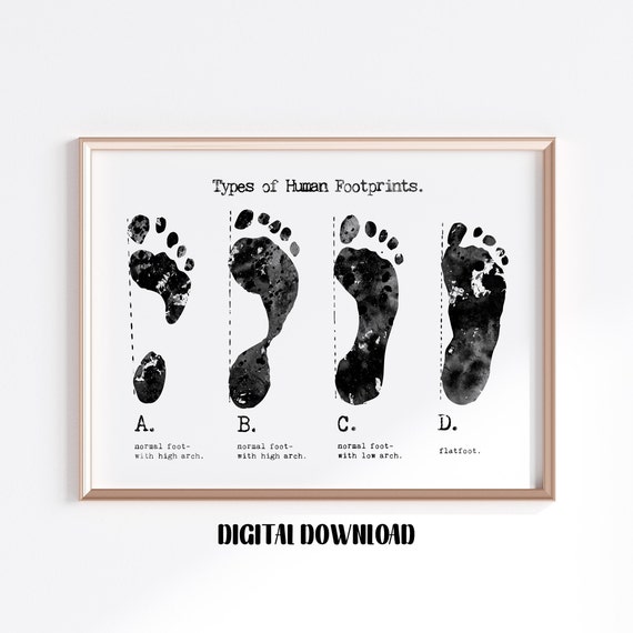 Types of Footprints Orthopedics Art Podiatry Decor Biology Etsy