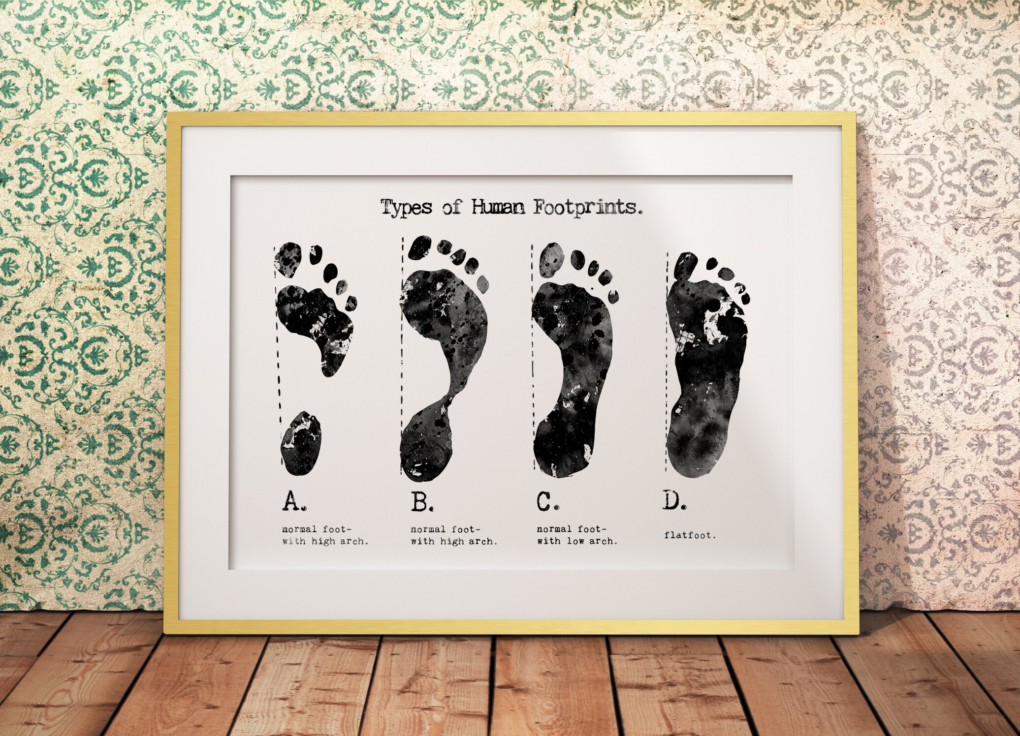 Types of Footprints Orthopedics Art Podiatry Decor Biology Etsy