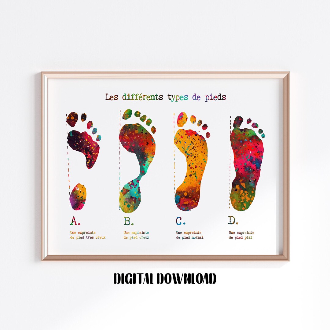 Types of Footprints With French Text Orthopedics Art Podiatry Etsy