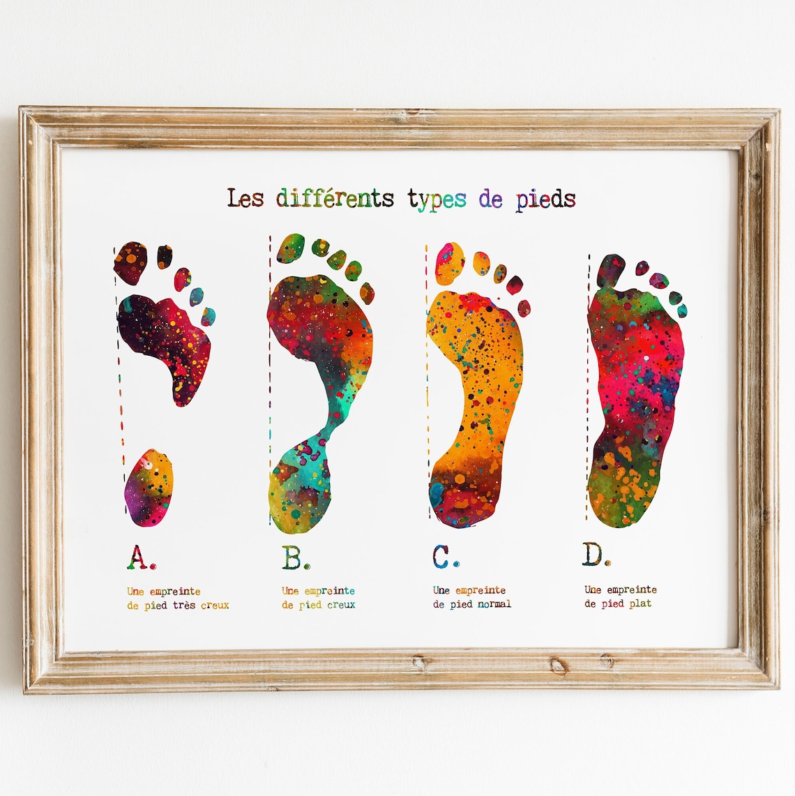Types of Footprints With French Text Orthopedics Art Podiatry Etsy