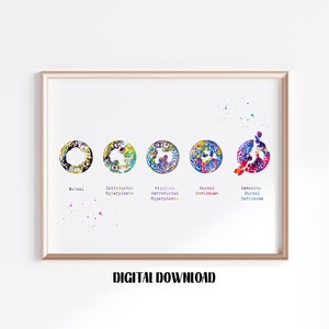 Breast Cancer Anatomy Watercolor Art Poster: Medical Science Print (Digital Download)