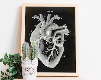 Anatomical Heart Print: Aged Medical Wall Art