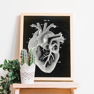 Anatomy Print, Heart Print, Anatomical drawing, Aged Anatomy Poster, Scientific Drawing, Medical Wall Art, Doctor Fast Track Shipping