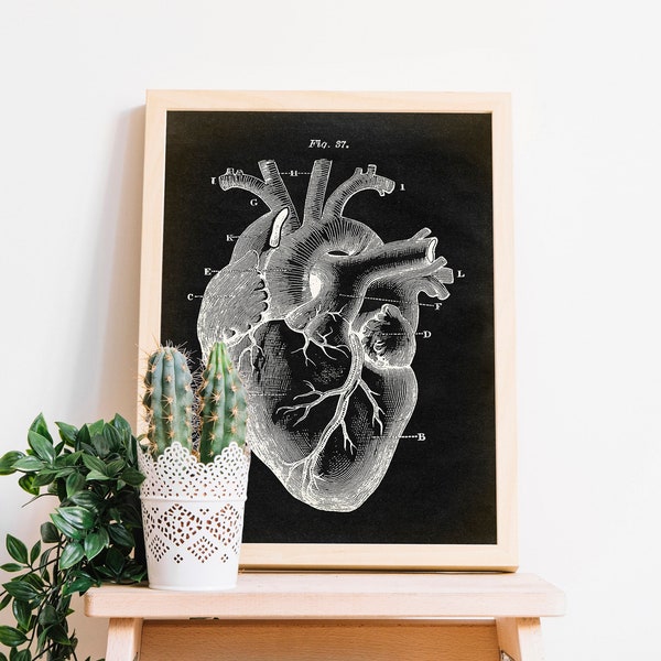 Anatomy Print, Heart Print, Anatomical drawing, Aged Anatomy Poster, Scientific Drawing, Medical Wall Art, Doctor Fast Track Shipping