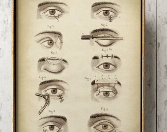 Impression d'anatomie des YEUX, affiche d'anatomie, dessin anatomique, illustration scientifique, tableau d'anatomie médicale, optométriste expédition accélérée