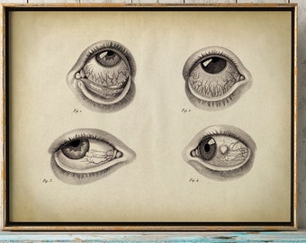 Eyes Anatomy print, vintage anatomy poster, medical wall art, doctor gift, anatomy poster, anatomy print, optometrist gift