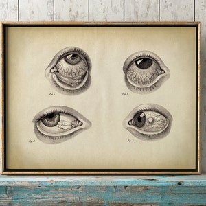 Eyes Anatomy print, vintage anatomy poster, medical wall art, doctor gift, anatomy poster, anatomy print, optometrist gift