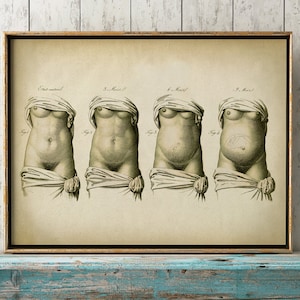 Schwangerschaft Anatomisch Poster, Fötus Vintage Anatomie Poster, Schwangere Medizinische Wandkunst, Mutter Anatomie Poster, Wissenschaftliche Anatomie Druck, Wohnkultur